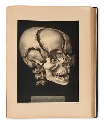 BOURGERY, JEAN-BAPTISTE-MARC. Descriptive or Physiological Anatomy . . . Volume the First. 1832 [i. e., 1833] + Atlas.  1833